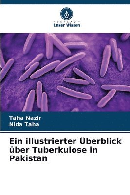 Ein illustrierter Überblick über Tuberkulose in Pakistan 1