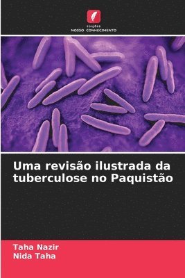 bokomslag Uma revisão ilustrada da tuberculose no Paquistão