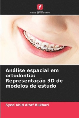 Análise espacial em ortodontia: Representação 3D de modelos de estudo 1