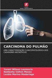 bokomslag Carcinoma Do Pulmão