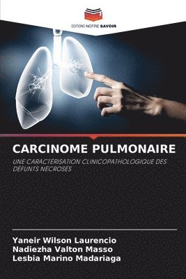 bokomslag Carcinome Pulmonaire