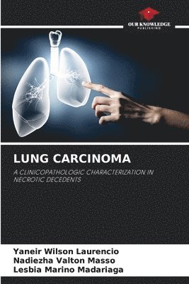 bokomslag Lung Carcinoma