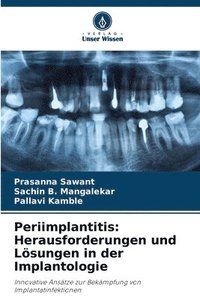 bokomslag Periimplantitis: Herausforderungen und Lösungen in der Implantologie