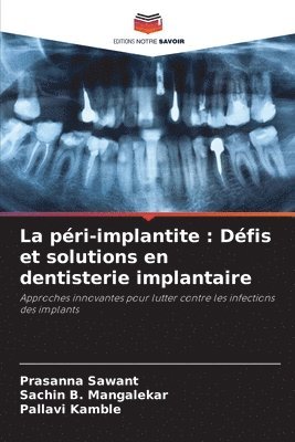 bokomslag La péri-implantite: Défis et solutions en dentisterie implantaire