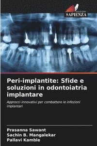 bokomslag Peri-implantite