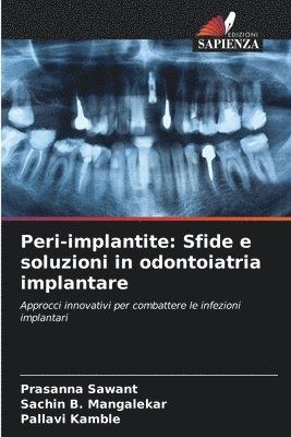 bokomslag Peri-implantite