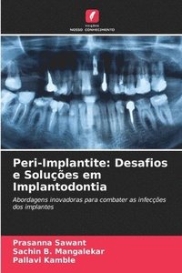 bokomslag Peri-Implantite: Desafios e Soluções em Implantodontia