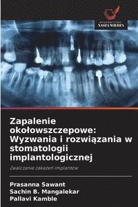 bokomslag Zapalenie okolowszczepowe: Wyzwania i rozwi&#261;zania w stomatologii implantologicznej