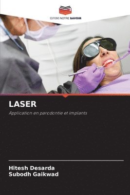 Laser 1