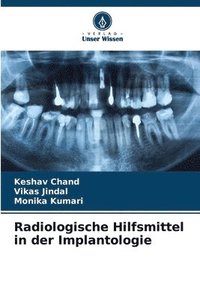 bokomslag Radiologische Hilfsmittel in der Implantologie