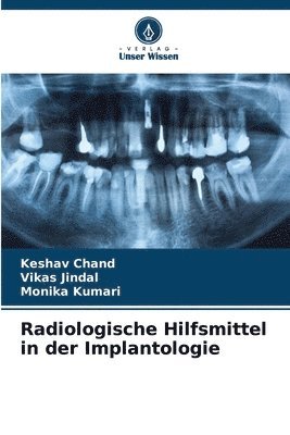 Radiologische Hilfsmittel in der Implantologie 1