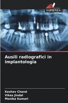 bokomslag Ausili radiografici in implantologia