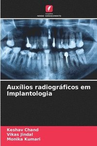 bokomslag Auxlios radiogrficos em Implantologia