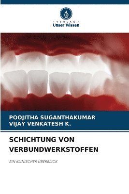 Schichtung Von Verbundwerkstoffen
