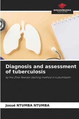 bokomslag Diagnosis and assessment of tuberculosis