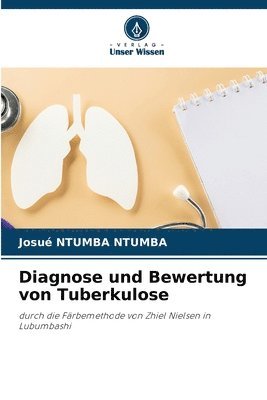 bokomslag Diagnose und Bewertung von Tuberkulose