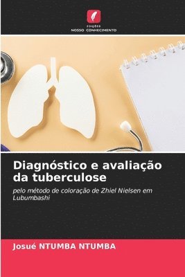 bokomslag Diagnstico e avaliao da tuberculose