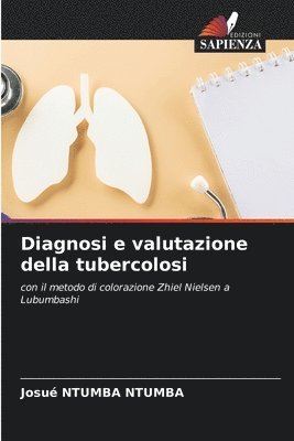 bokomslag Diagnosi e valutazione della tubercolosi