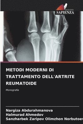 Metodi Moderni Di Trattamento Dell'artrite Reumatoide 1