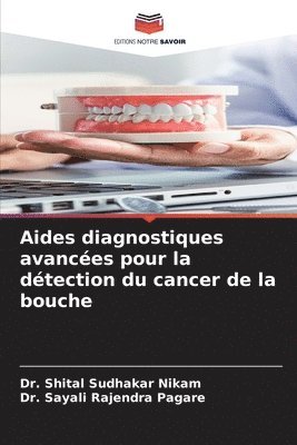 bokomslag Aides diagnostiques avances pour la dtection du cancer de la bouche