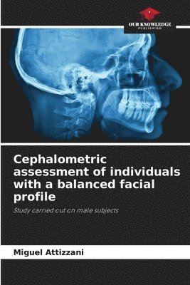 Cephalometric assessment of individuals with a balanced facial profile 1