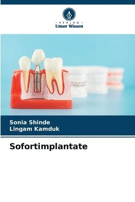 Sofortimplantate 1