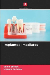 bokomslag Implantes imediatos