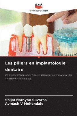 Les piliers en implantologie dentaire 1