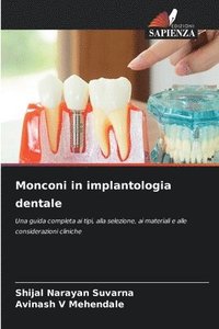 bokomslag Monconi in implantologia dentale