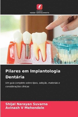 bokomslag Pilares em Implantologia Dentária