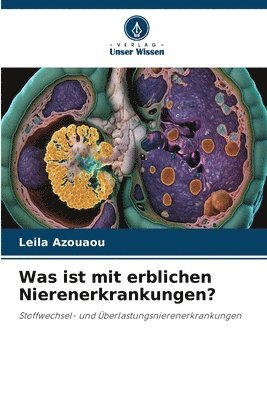 Was ist mit erblichen Nierenerkrankungen? 1