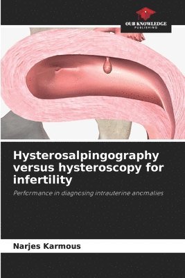 Hysterosalpingography versus hysteroscopy for infertility 1