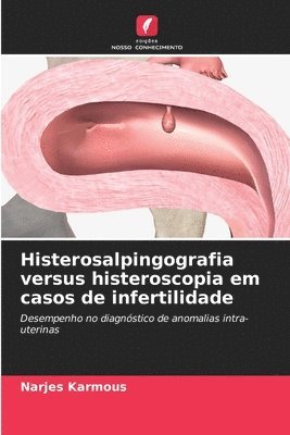 Histerosalpingografia versus histeroscopia em casos de infertilidade 1