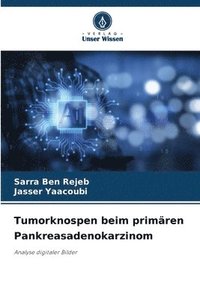 bokomslag Tumorknospen beim primären Pankreasadenokarzinom