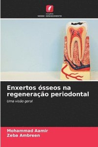 bokomslag Enxertos ósseos na regeneração periodontal