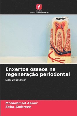 bokomslag Enxertos sseos na regenerao periodontal