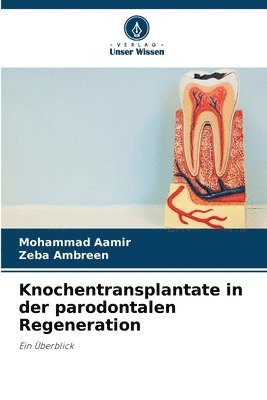 bokomslag Knochentransplantate in der parodontalen Regeneration