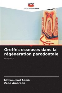 bokomslag Greffes osseuses dans la rgnration parodontale