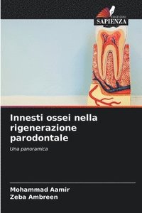 bokomslag Innesti ossei nella rigenerazione parodontale