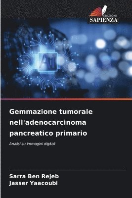 bokomslag Gemmazione tumorale nell'adenocarcinoma pancreatico primario