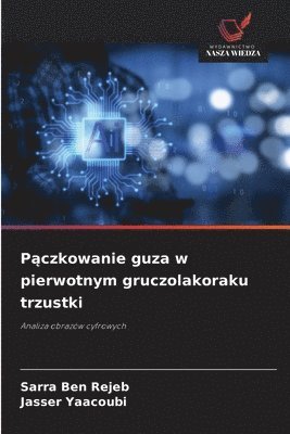 bokomslag P?czkowanie guza w pierwotnym gruczolakoraku trzustki