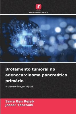 bokomslag Brotamento tumoral no adenocarcinoma pancreático primário