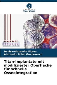 bokomslag Titan-Implantate mit modifizierter Oberfläche für schnelle Osseointegration