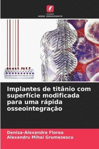 bokomslag Implantes de titnio com superfcie modificada para uma rpida osseointegrao