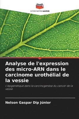 Analyse de l'expression des micro-ARN dans le carcinome urothélial de la vessie 1