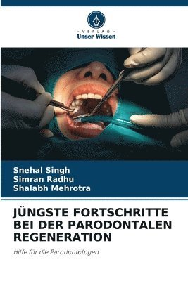 Snehal Singh, Simran Radhu, Shalabh Mehrotra - Jüngste Fortschritte Bei Der Parodontalen Regeneration, Häftad