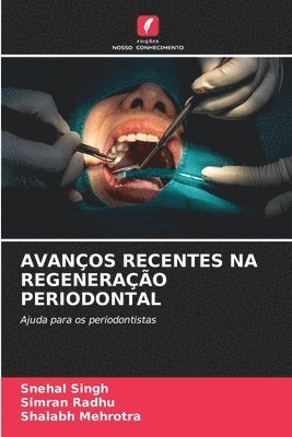 Snehal Singh, Simran Radhu, Shalabh Mehrotra - Avanços Recentes Na Regeneração Periodontal, Häftad