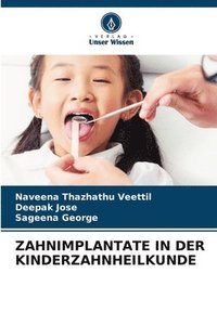 bokomslag Zahnimplantate in Der Kinderzahnheilkunde
