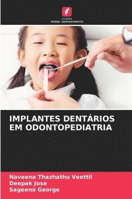 Implantes Dentários Em Odontopediatria