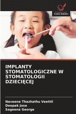 Naveena Thazhathu Veettil, Deepak Jose, Sageena George - Implanty Stomatologiczne W Stomatologii DzieciĘcej, Häftad